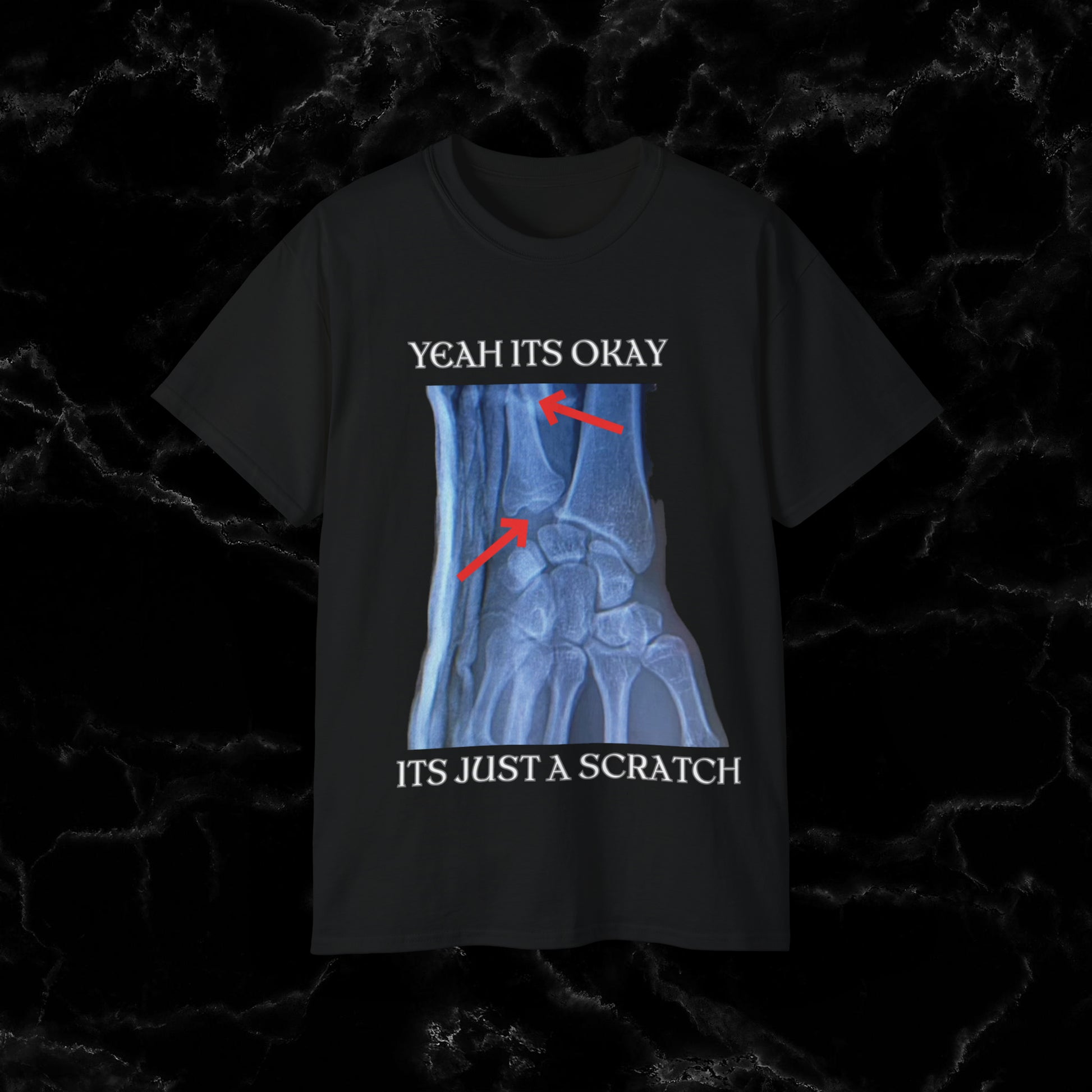 Resilient Hand X-Ray Art - Dan Hooker Australia 'Yeah Its Okay Its Just A Scratch" T-shirt T-Shirt Black S 