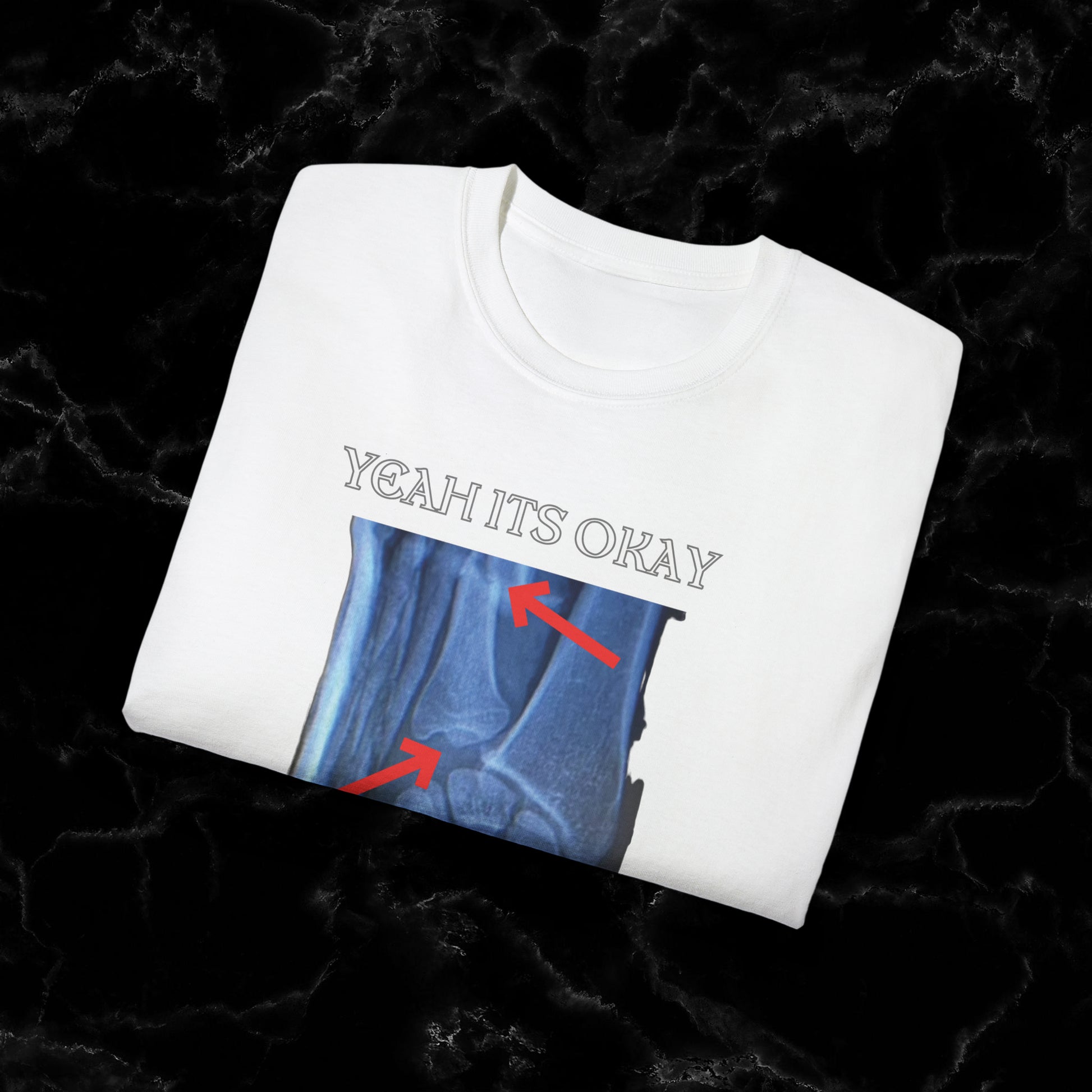 Resilient Hand X-Ray Art - Dan Hooker Australia 'Yeah Its Okay Its Just A Scratch" T-shirt T-Shirt   