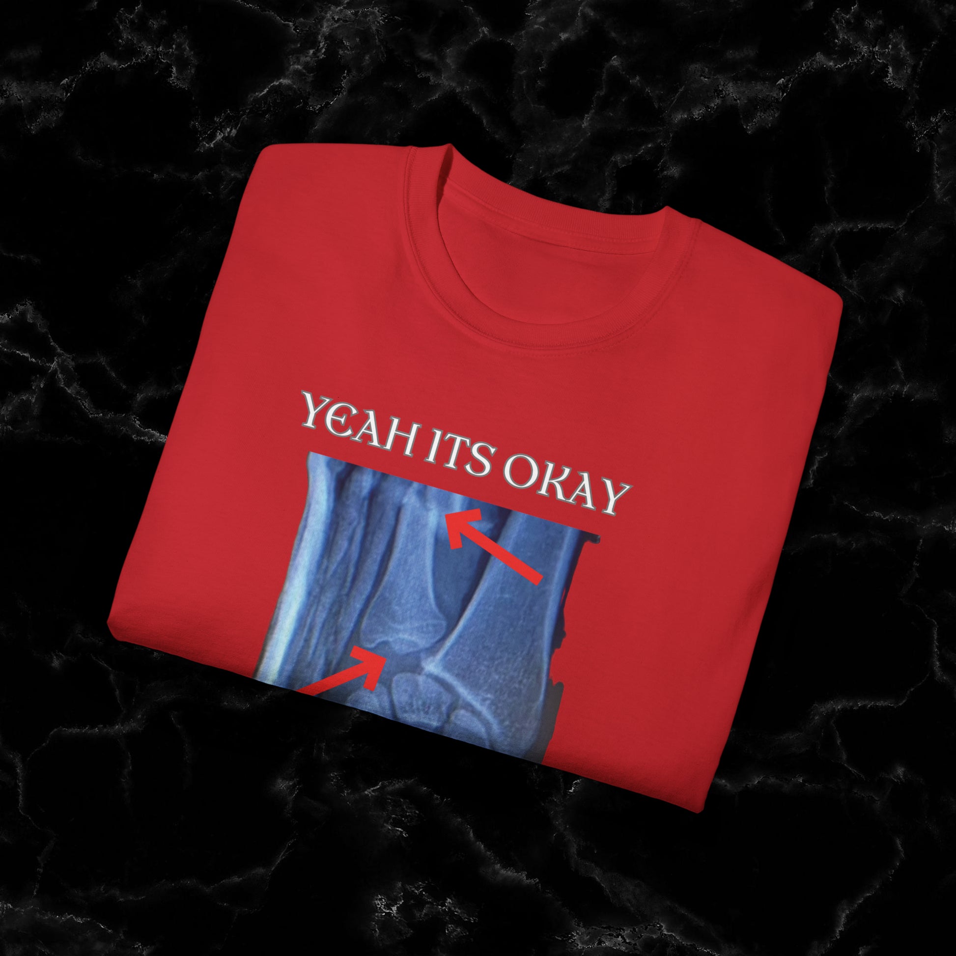 Resilient Hand X-Ray Art - Dan Hooker Australia 'Yeah Its Okay Its Just A Scratch" T-shirt T-Shirt   