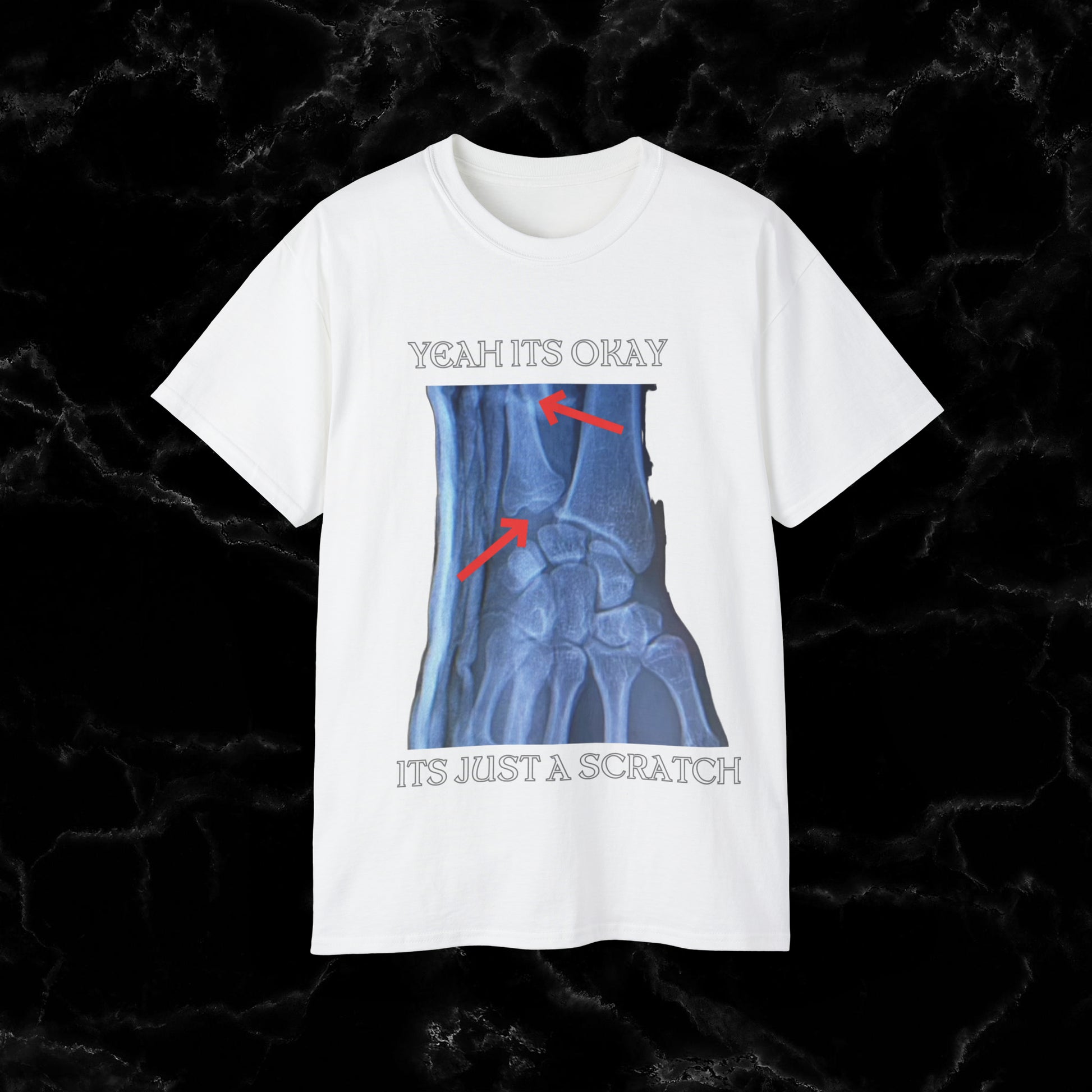 Resilient Hand X-Ray Art - Dan Hooker Australia 'Yeah Its Okay Its Just A Scratch" T-shirt T-Shirt White S 